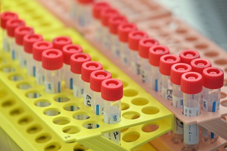  Tube de prélèvement 